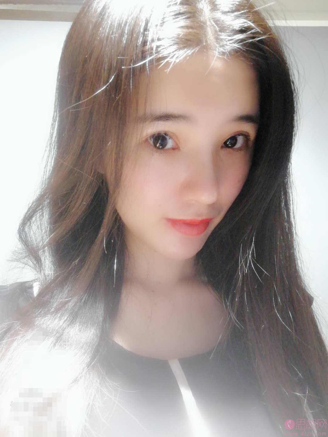 深圳美莱梁晓健鼻子做的好不好?真实案例图及2021价格表明细一览