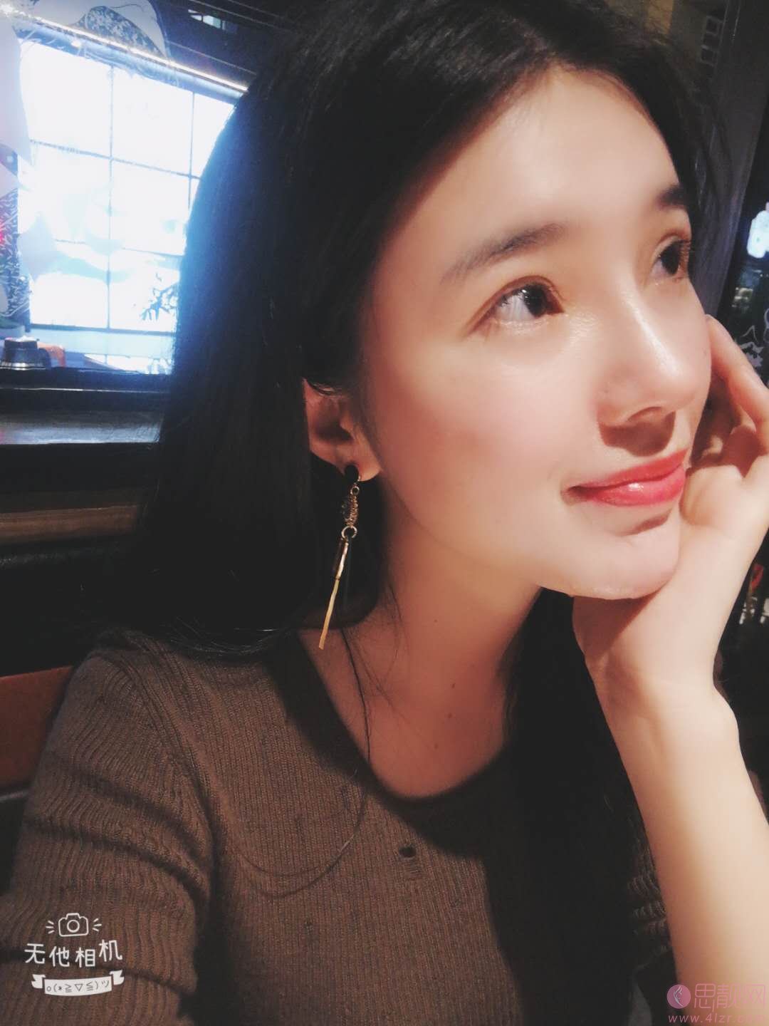 深圳美莱梁晓健鼻子做的好不好?真实案例图及2021价格表明细一览