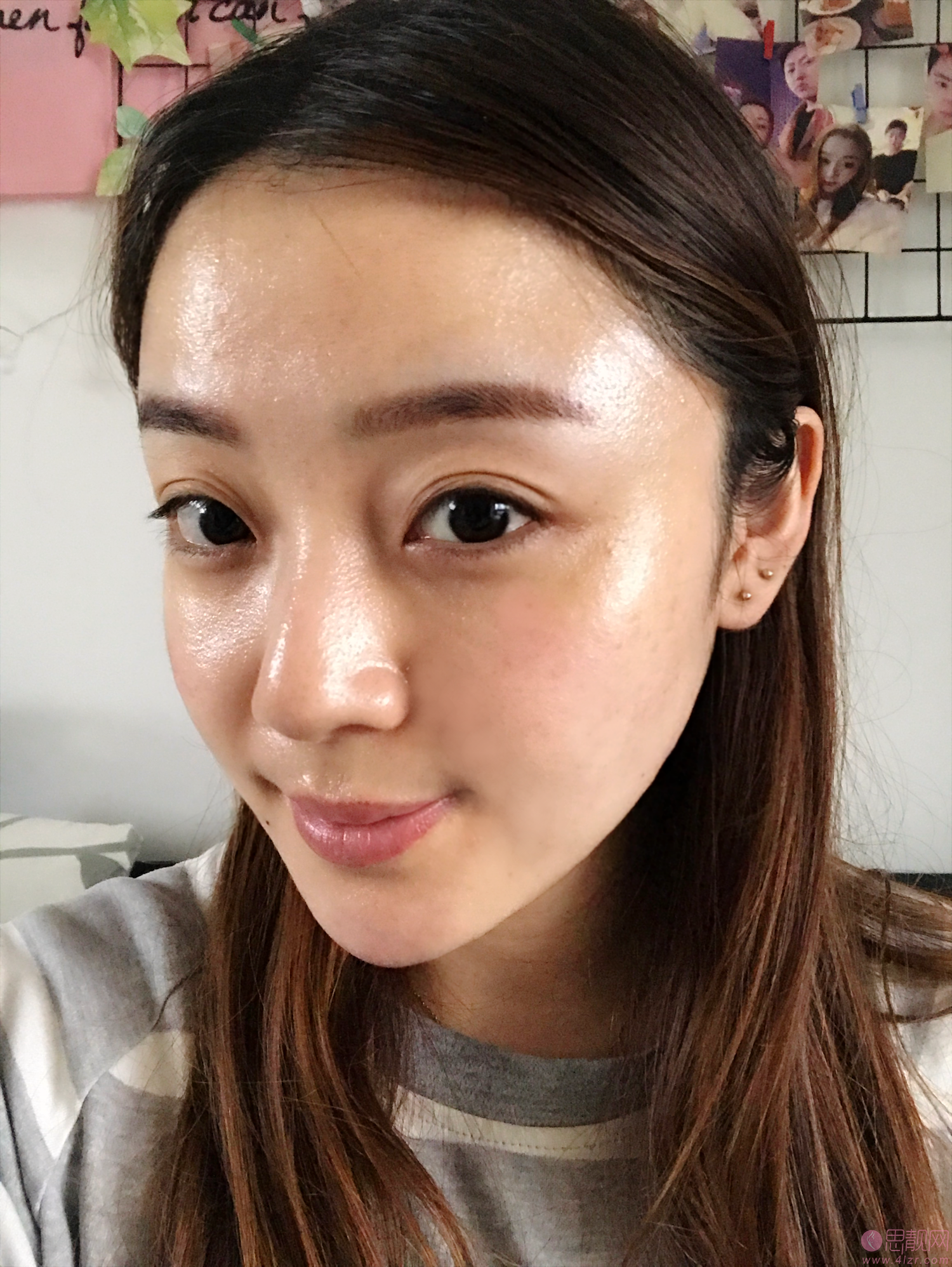 四川华美紫馨医学美容医院靠谱吗？附医院介绍及自体脂肪填充案例
