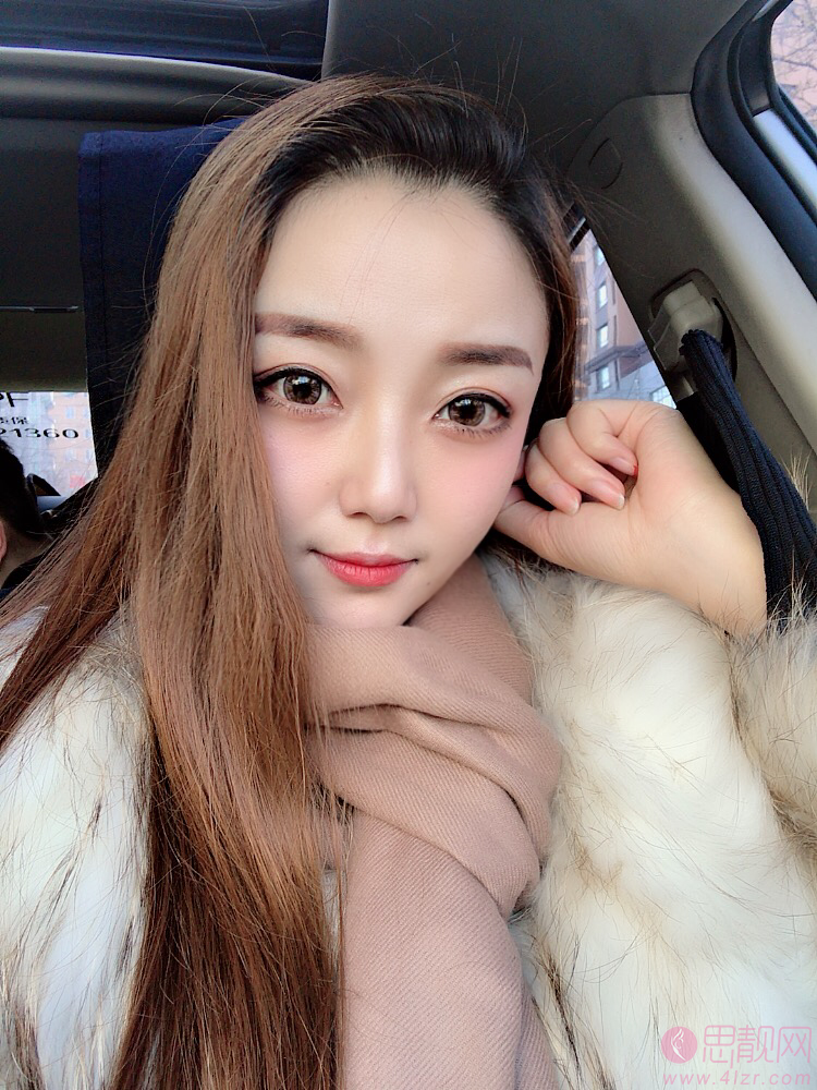四川华美紫馨医学美容医院靠谱吗？附医院介绍及自体脂肪填充案例