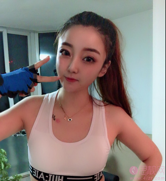 四川华美紫馨医学美容医院靠谱吗？附医院介绍及自体脂肪填充案例