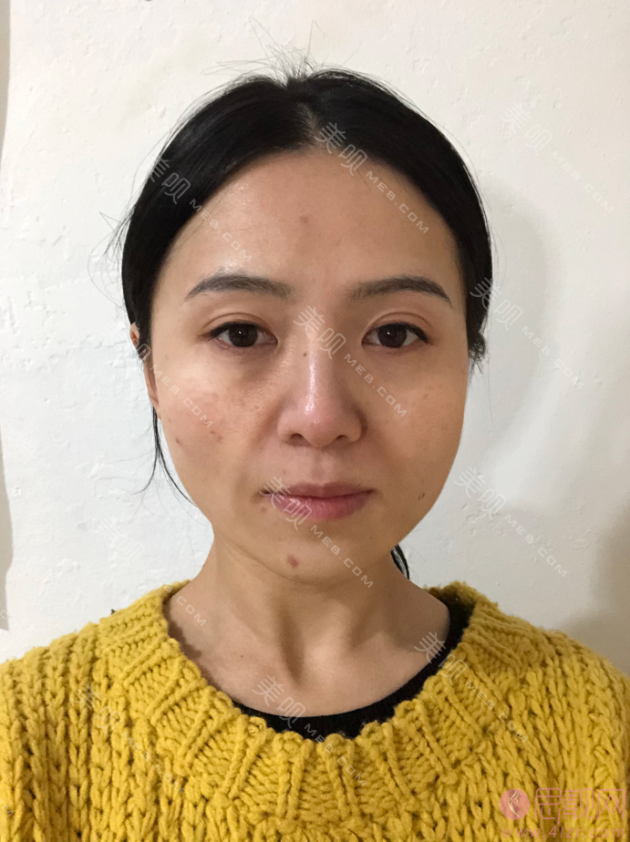 北京艾玛医疗美容诊所韦元强脂肪修复多少钱？附修复案例及2021价格表曝光