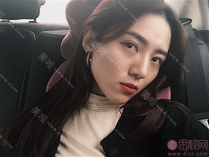 北京艾玛医疗美容诊所韦元强脂肪修复多少钱？附修复案例及2021价格表曝光