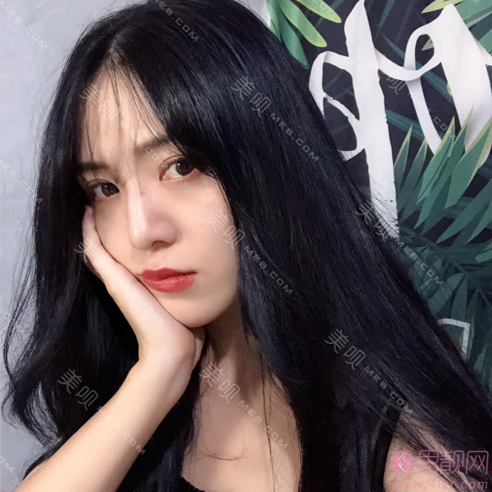 北京艾玛医疗美容诊所韦元强脂肪修复多少钱？附修复案例及2021价格表曝光