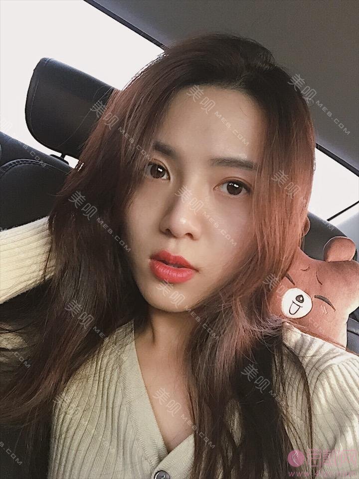 北京艾玛医疗美容诊所韦元强脂肪修复多少钱？附修复案例及2021价格表曝光