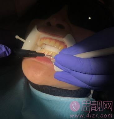 济南维乐口腔2021价格表公开+牙齿美白案例分享