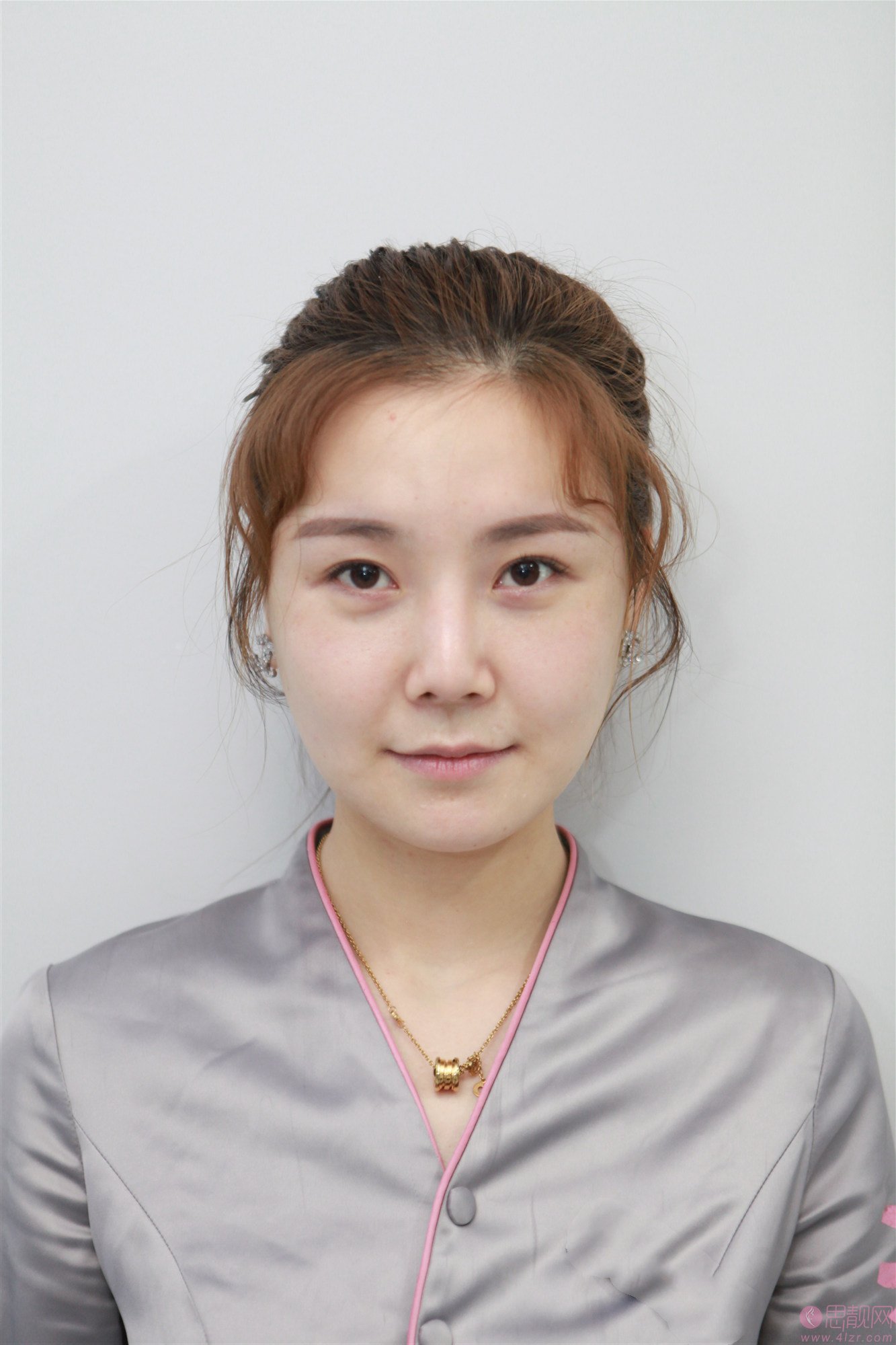 重庆铂生医疗美容医院怎么样?2021价格表曝光+线雕日记分享