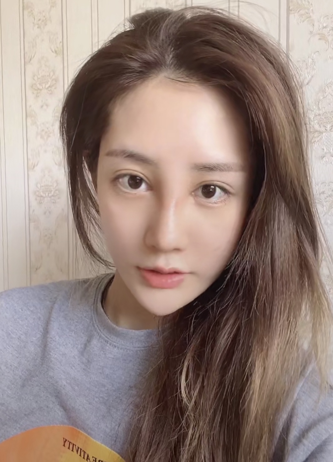郑州东方整形美容医院隆鼻好不好？附隆鼻案例+2021价格表上线