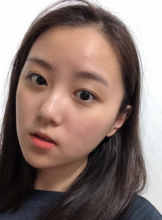 姜民范颧骨手术怎么样?附案例及2021价格表曝光 姜民范颧骨手术怎么样?附案例及2021价格表曝光