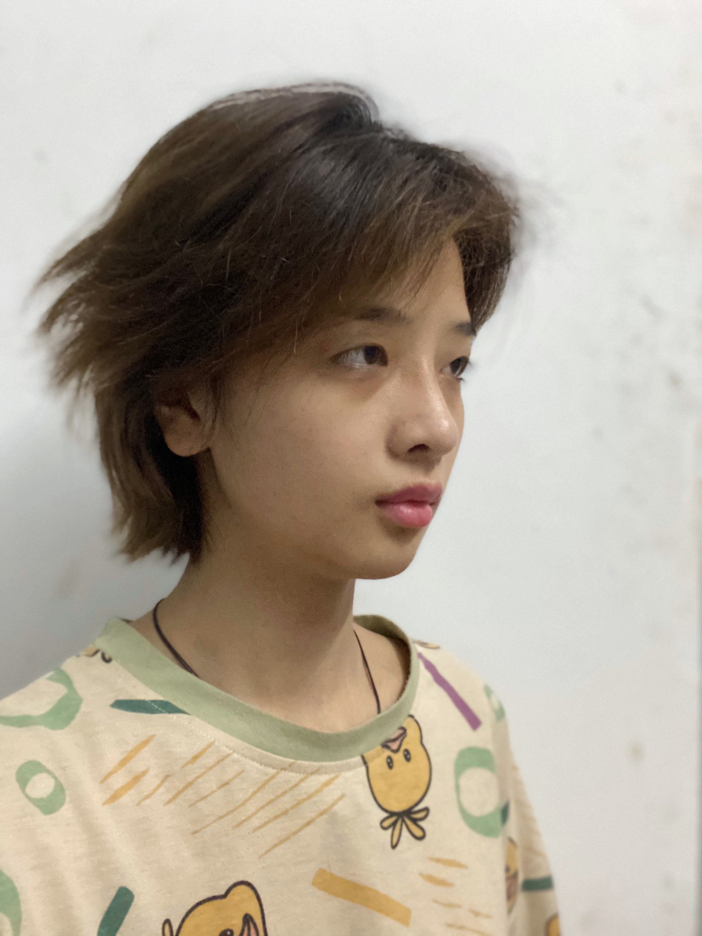 重庆星荣整形外科医院吕巍做双眼皮怎么样？附医生信息介绍+双眼皮案例分享