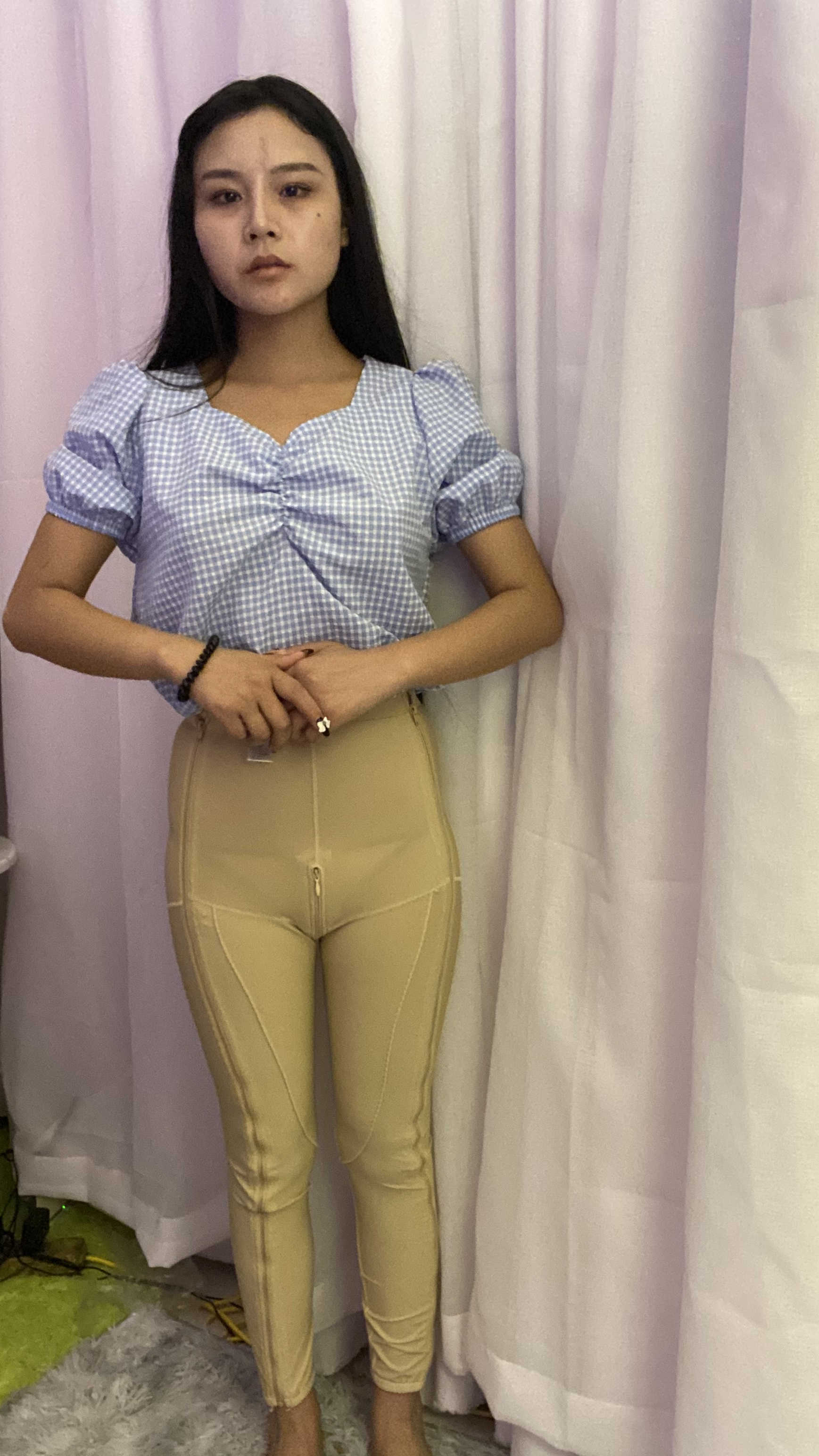 南京美莱吸脂怎么样？附大腿吸脂案例及2021价格表曝光