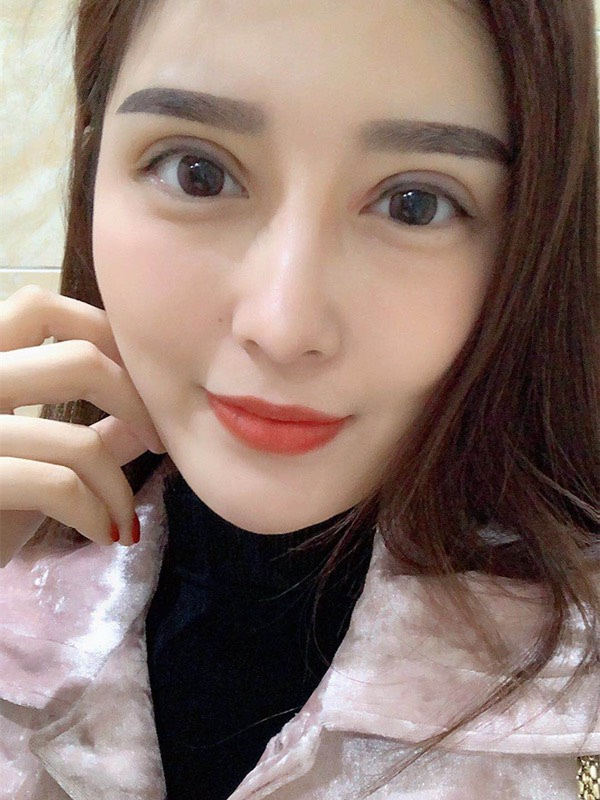 齐尚华院长眼修复做的怎么样？附双眼皮修复案例一览