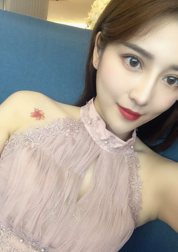 齐尚华院长眼修复做的怎么样？附双眼皮修复案例一览