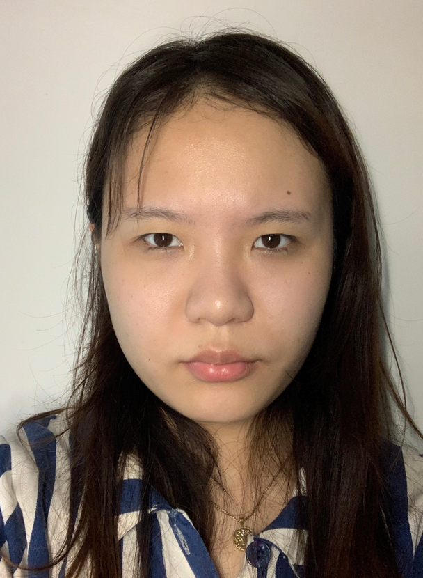 南宁华美整形美容医院价格表2021价格表曝光+双眼皮案例分享
