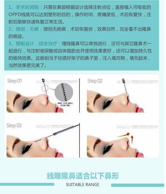 线雕隆鼻会完全吸收吗