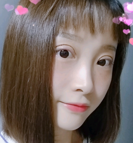 广州美莱田跃平做双眼皮怎么样？附双眼皮案例及2021价格表曝光