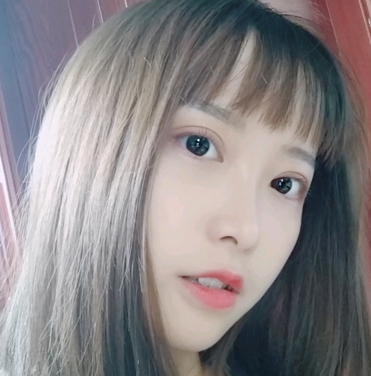 广州美莱田跃平做双眼皮怎么样？附双眼皮案例及2021价格表曝光