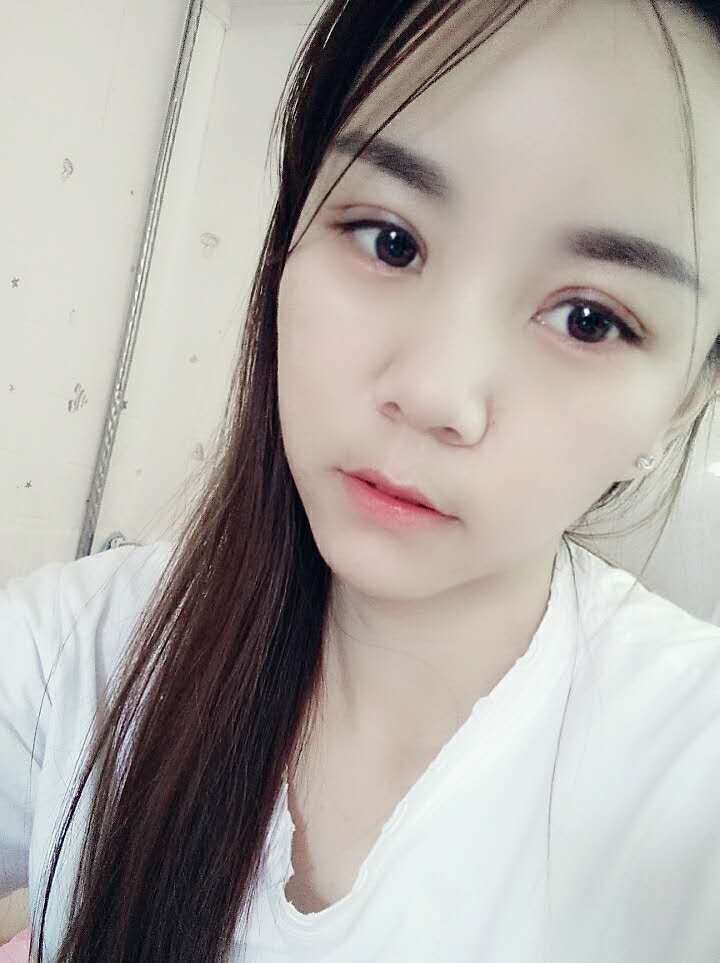 北京圣慈医疗美容医院怎么样？附双眼皮真人案例及2021价格表发布