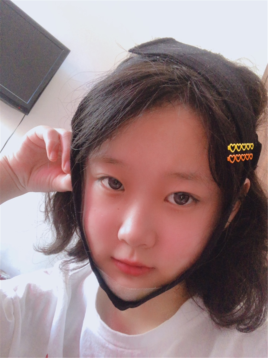上海美联臣曹栋弼磨骨怎么样？磨骨案例分反馈+2021价格表