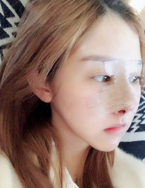 成都蜀尚蓉雅美容整形口碑怎么样？附医院介绍+隆鼻案例分享