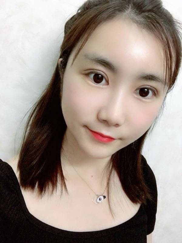 成都市西区医院段焘做双眼皮怎么样？双眼皮术后效果反馈+2021价格表