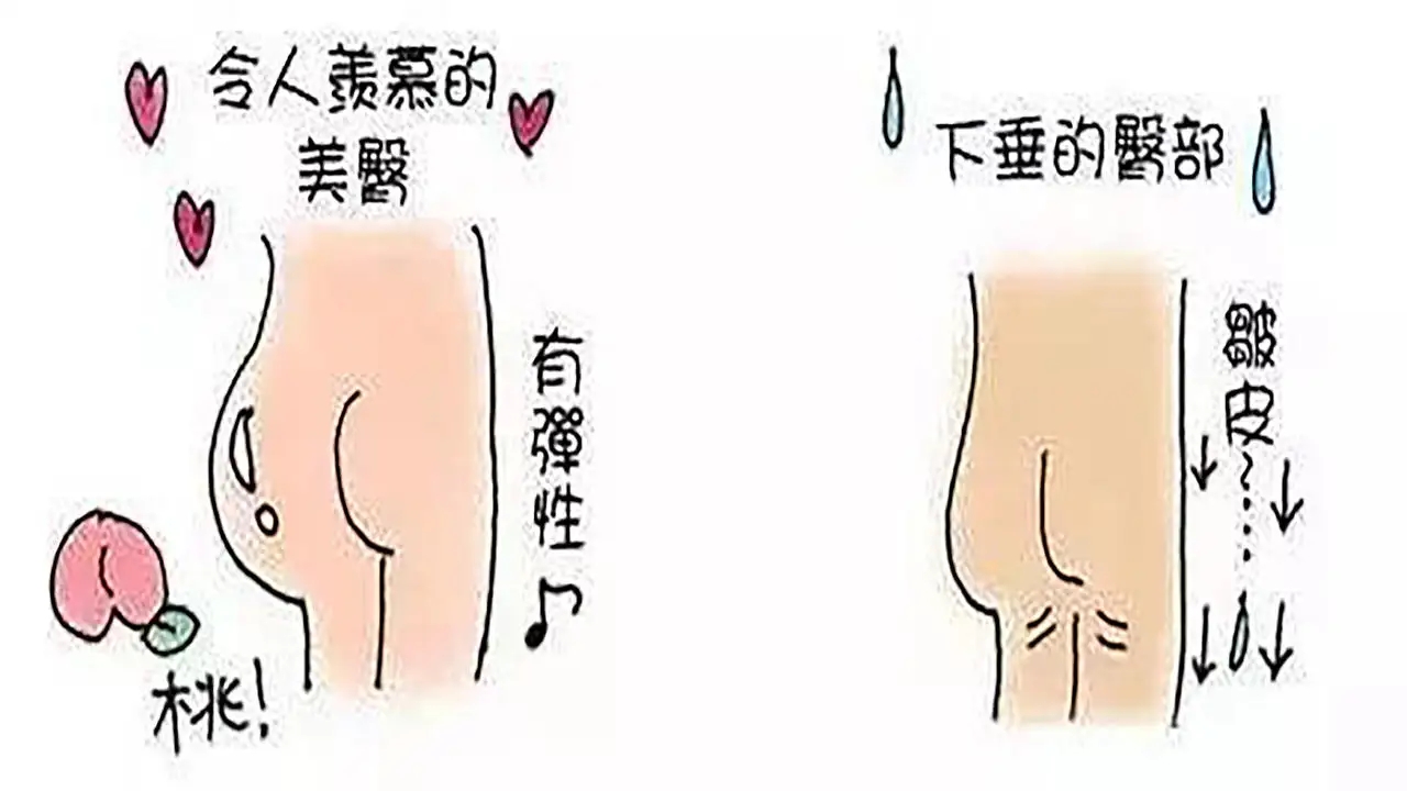 丰臀的时候该注意那些细节呢