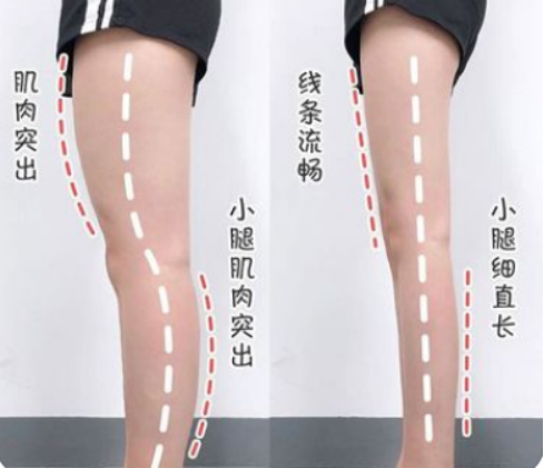 动氧瘦大腿和动氧瘦小腿手术过程如何