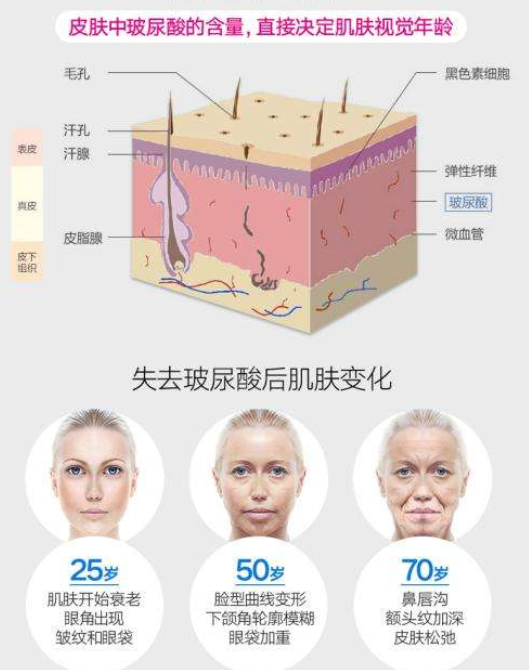 经常打玻尿酸有什么效果
