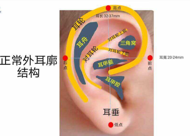 带你了解什么是耳部整形手术