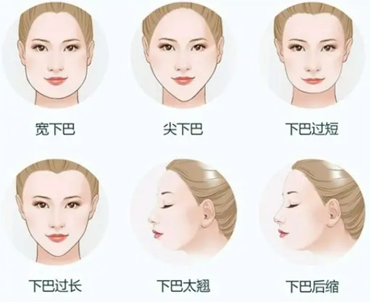 垫下巴有用吗垫下巴优缺点必看~