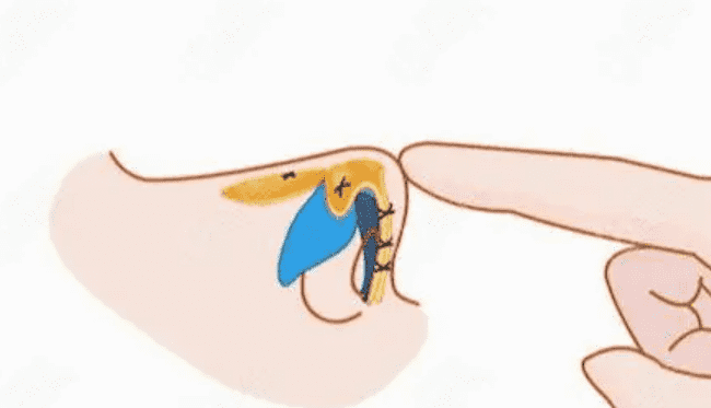 上海自体软骨隆鼻需要多少钱快来看看吧