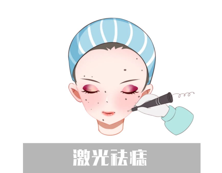祛斑祛痣方法有哪些