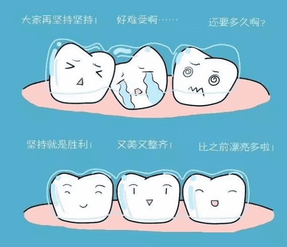 东莞市人民医院牙齿矫正的效果如何附案例简介
