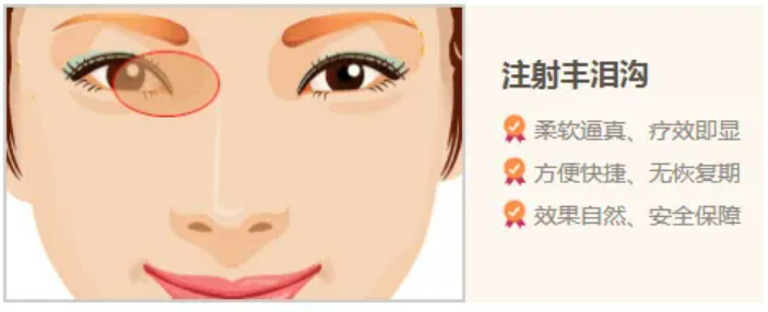 玻尿酸填泪沟可以维持多长时间原来有这些优势~