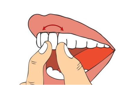 杭州维乐口腔好不好医院口碑评价~