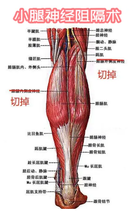 小腿神经阻断术优势有什么