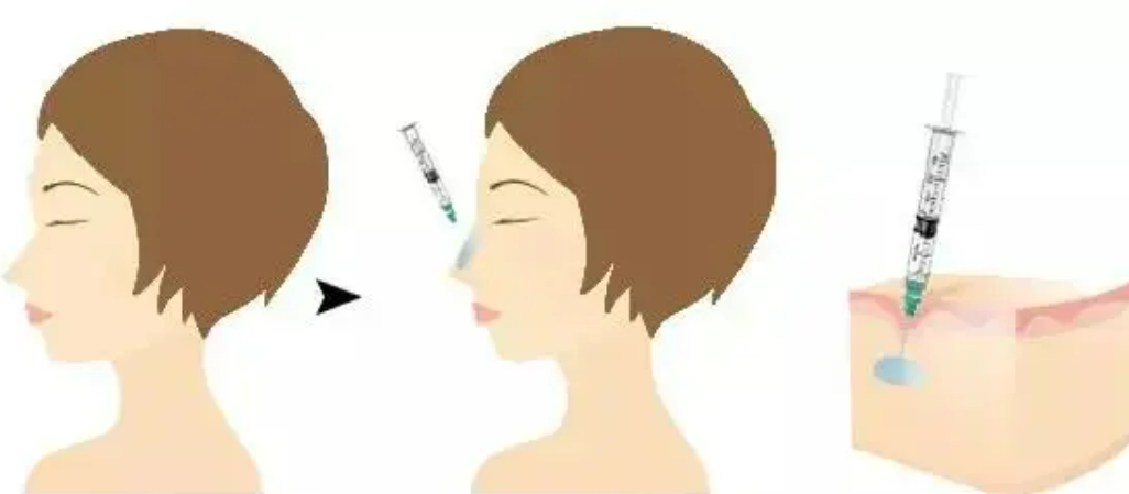 广州可玫尔艺美医疗美容项目有哪些有哪些专业的医生