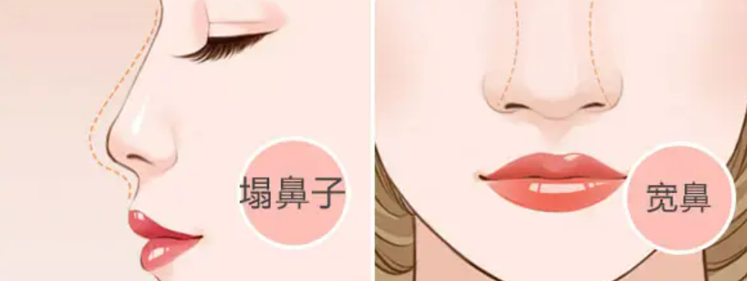 广州鹏爱医疗美容有哪些医生快来看看吧