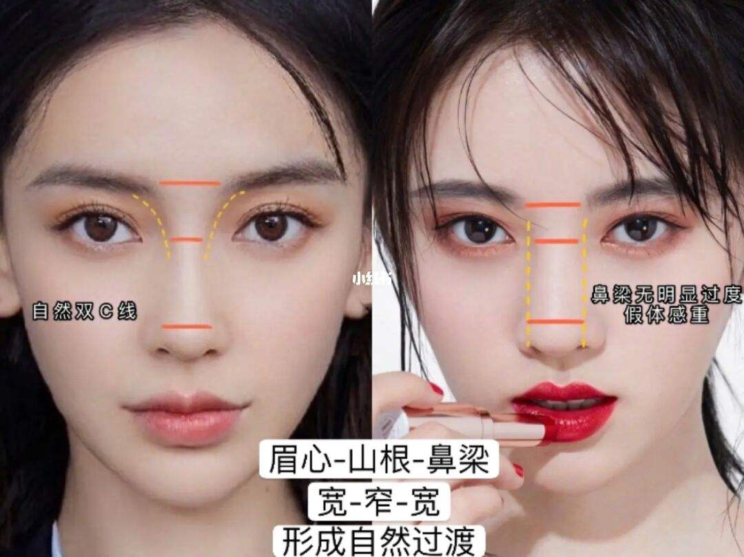 鼻部整形包含的项目有哪些呢