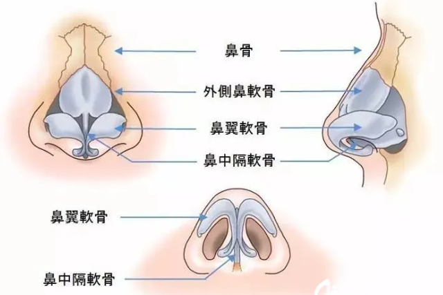 鼻孔矫正的方法有哪些