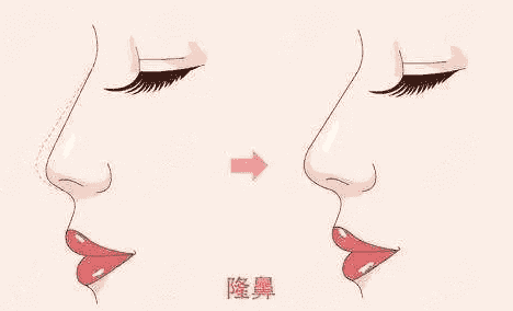 郑州隆鼻修复医院排名榜，均为综合评分8分以上的机构