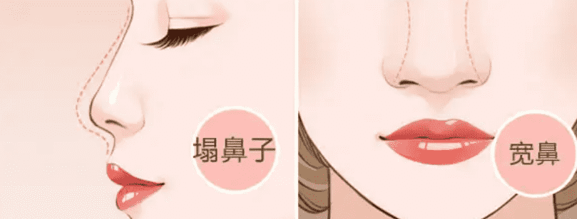 北京第306医院整形怎么样综合分析得出~