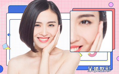 眼部