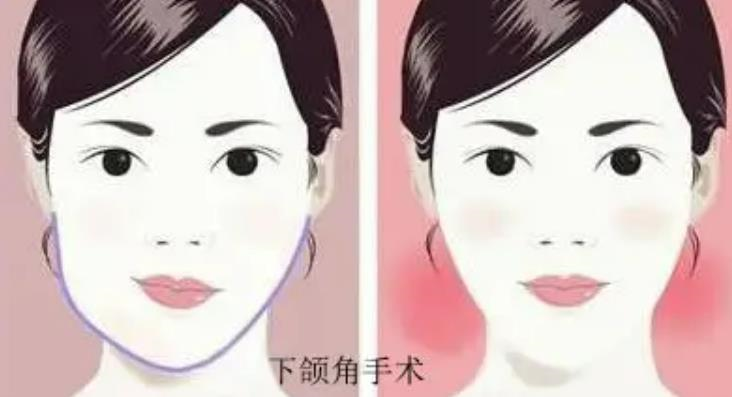 中国航天731医院整形怎么样达人干货分享~