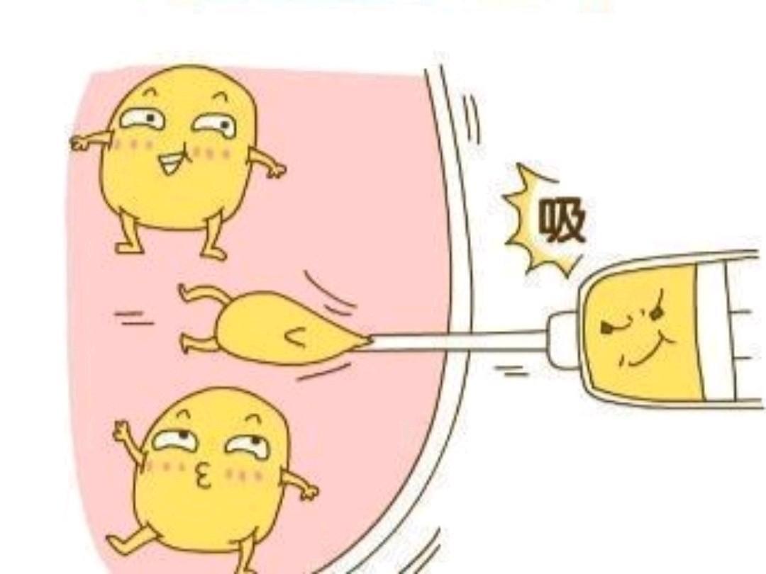 做了吸脂手术之后怎样才能快起恢复？