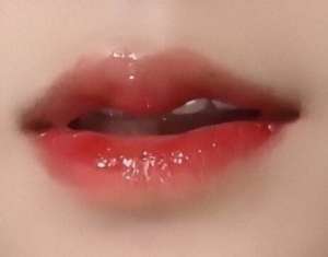 做完唇部综合要多久才能恢复？