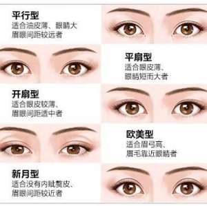 双眼皮有几种款式？那种最流行？